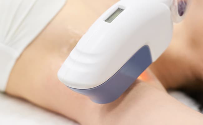 女性接受雷射除毛療程，專業美容操作
